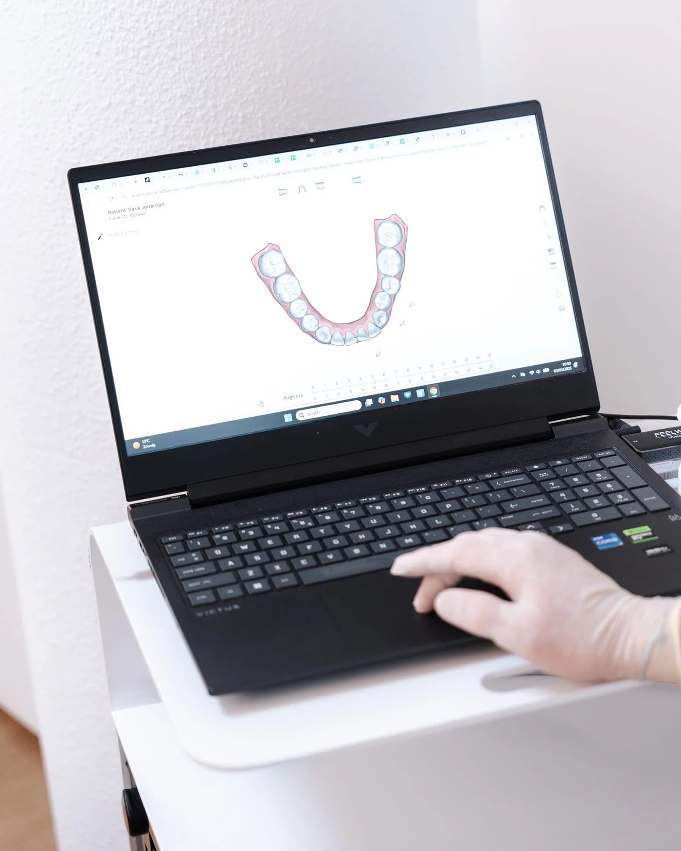 Ortho support on every case
