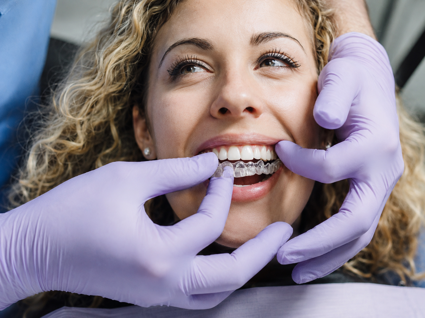Clear Aligners